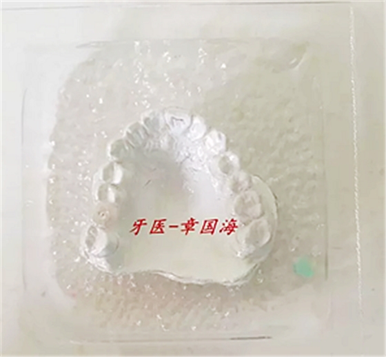 種植導(dǎo)板制作 種植導(dǎo)板制作