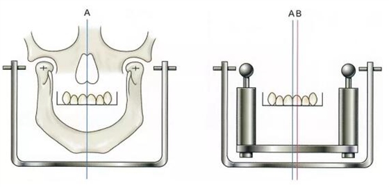 面弓實(shí)際應(yīng)用上的問題 面弓實(shí)際應(yīng)用上的問題