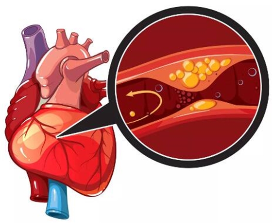 這 3 種全身系統(tǒng)疾病，與口腔健康密切相關(guān)！