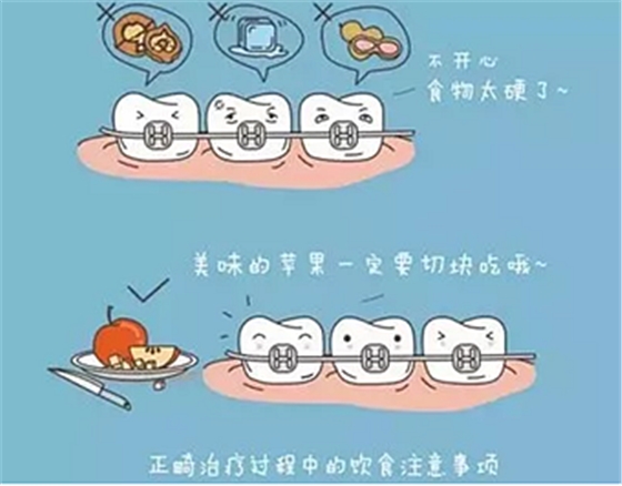 正畸需要注意些什么？