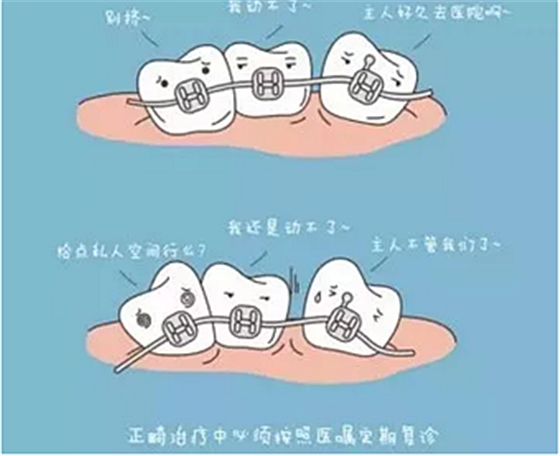 正畸需要注意些什么？