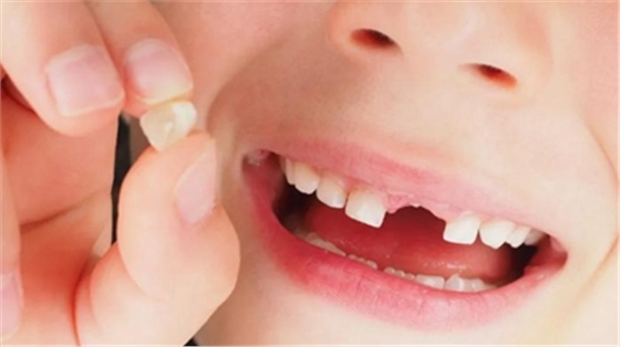 孩子長出「雙排牙」，家長們要注意了