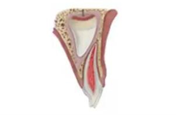 臨床實踐|乳牙外傷處理指引(值得兒牙醫(yī)生收藏) 臨床實踐|乳牙外傷處理指引(值得兒牙醫(yī)生收藏)