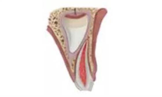 臨床實踐|乳牙外傷處理指引(值得兒牙醫(yī)生收藏) 臨床實踐|乳牙外傷處理指引(值得兒牙醫(yī)生收藏)