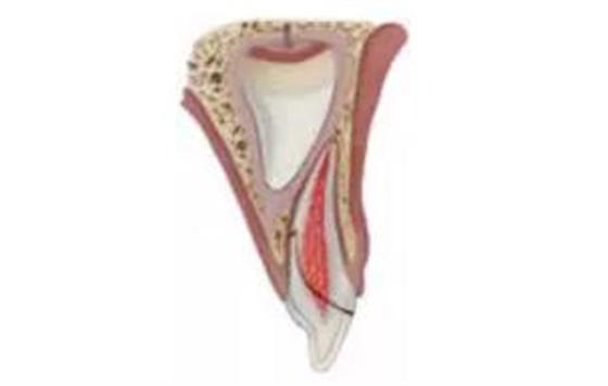 臨床實踐|乳牙外傷處理指引(值得兒牙醫(yī)生收藏) 臨床實踐|乳牙外傷處理指引(值得兒牙醫(yī)生收藏)