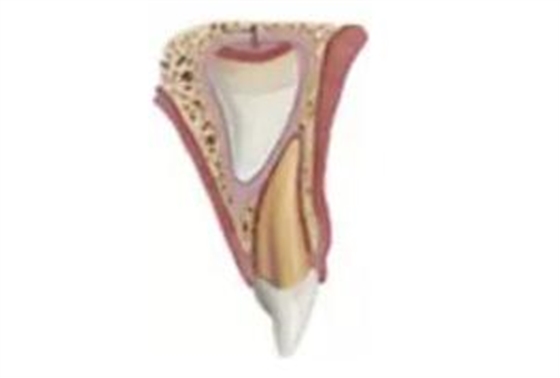 臨床實踐|乳牙外傷處理指引(值得兒牙醫(yī)生收藏) 臨床實踐|乳牙外傷處理指引(值得兒牙醫(yī)生收藏)