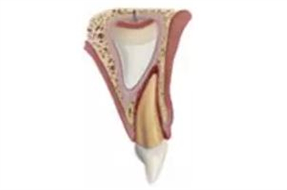 臨床實踐|乳牙外傷處理指引(值得兒牙醫(yī)生收藏) 臨床實踐|乳牙外傷處理指引(值得兒牙醫(yī)生收藏)