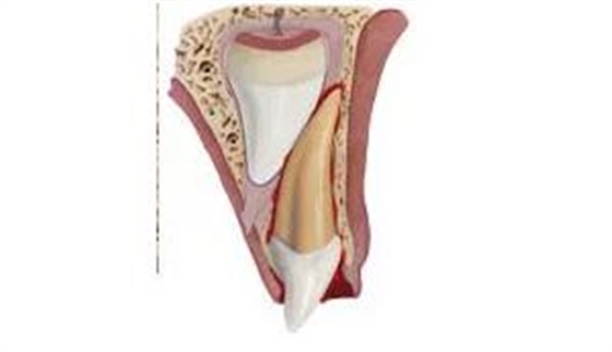 臨床實踐|乳牙外傷處理指引(值得兒牙醫(yī)生收藏) 臨床實踐|乳牙外傷處理指引(值得兒牙醫(yī)生收藏)