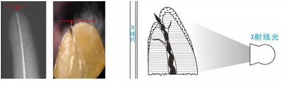 多頻技術(shù)的根管長(zhǎng)度測(cè)定儀 多頻技術(shù)的根管長(zhǎng)度測(cè)定儀