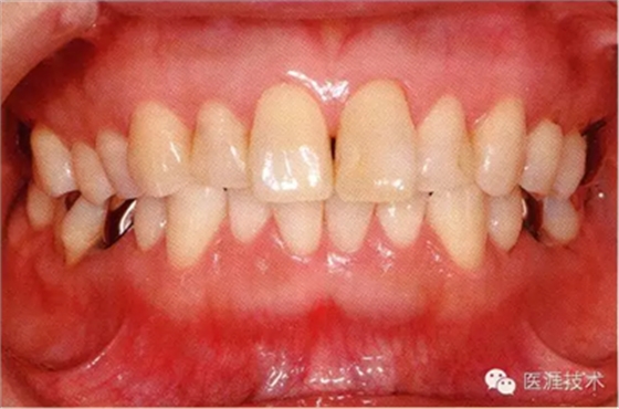 上海品瑞邁格磁致伸縮治療儀 上海品瑞邁格磁致伸縮治療儀