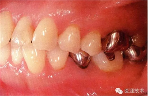 上海品瑞邁格磁致伸縮治療儀 上海品瑞邁格磁致伸縮治療儀