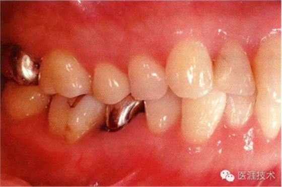 上海品瑞邁格磁致伸縮治療儀 上海品瑞邁格磁致伸縮治療儀