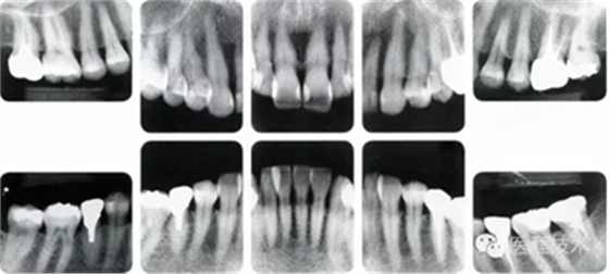 上海品瑞邁格磁致伸縮治療儀 上海品瑞邁格磁致伸縮治療儀
