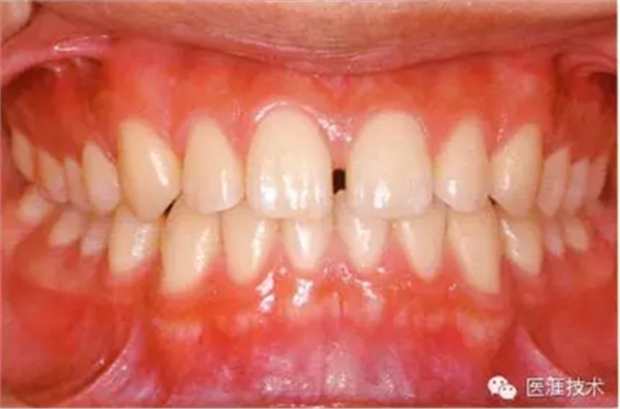 上海品瑞邁格磁致伸縮治療儀 上海品瑞邁格磁致伸縮治療儀