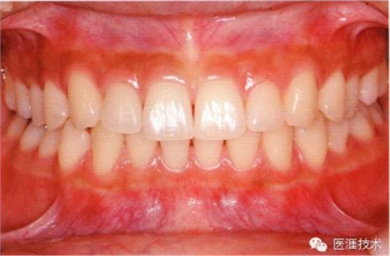 上海品瑞邁格磁致伸縮治療儀 上海品瑞邁格磁致伸縮治療儀