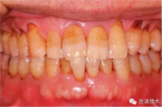 上海品瑞邁格磁致伸縮治療儀 上海品瑞邁格磁致伸縮治療儀