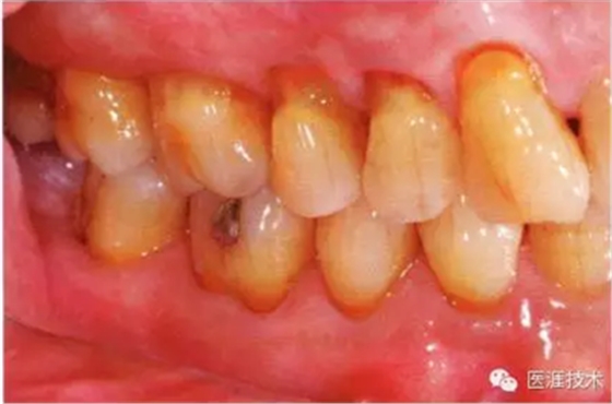 上海品瑞邁格磁致伸縮治療儀 上海品瑞邁格磁致伸縮治療儀