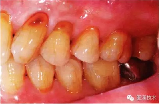 上海品瑞邁格磁致伸縮治療儀 上海品瑞邁格磁致伸縮治療儀