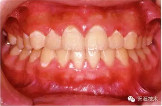 上海品瑞邁格磁致伸縮治療儀 上海品瑞邁格磁致伸縮治療儀