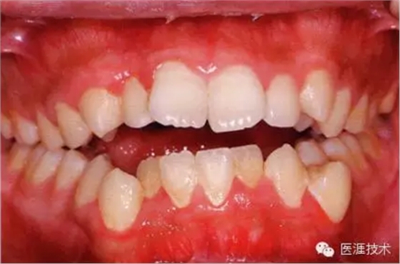 上海品瑞邁格磁致伸縮治療儀 上海品瑞邁格磁致伸縮治療儀