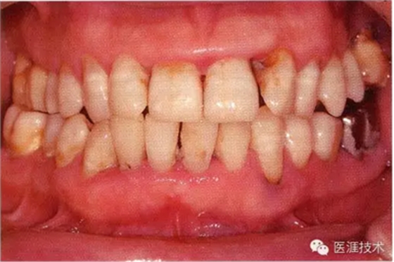 上海品瑞邁格磁致伸縮治療儀 上海品瑞邁格磁致伸縮治療儀