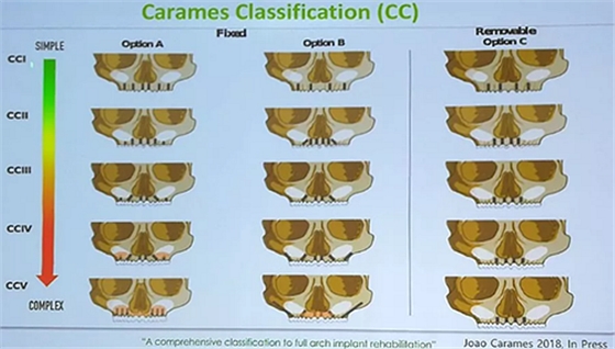 【熱點(diǎn)回顧】帶您深度了解無牙頜種植修復(fù)——Pro Arch 【熱點(diǎn)回顧】帶您深度了解無牙頜種植修復(fù)——Pro Arch