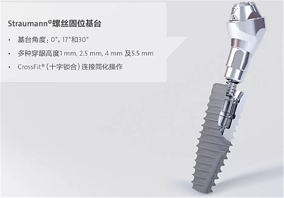 【熱點(diǎn)回顧】帶您深度了解無牙頜種植修復(fù)——Pro Arch 【熱點(diǎn)回顧】帶您深度了解無牙頜種植修復(fù)——Pro Arch