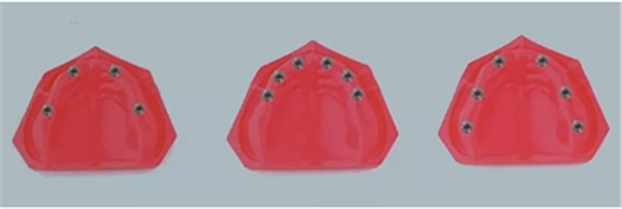 【熱點(diǎn)回顧】帶您深度了解無牙頜種植修復(fù)——Pro Arch 【熱點(diǎn)回顧】帶您深度了解無牙頜種植修復(fù)——Pro Arch