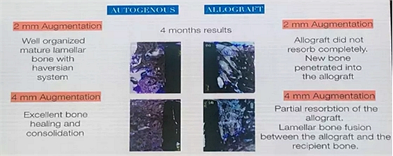 【聽課筆記】種植體周圍軟硬組織相關(guān)美學(xué)考量因素 【聽課筆記】種植體周圍軟硬組織相關(guān)美學(xué)考量因素