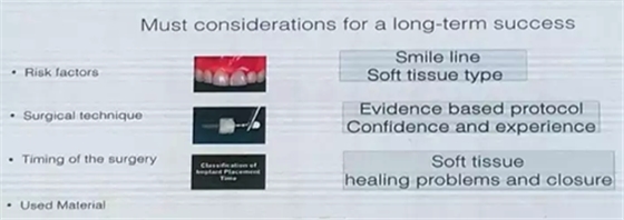 【聽課筆記】種植體周圍軟硬組織相關(guān)美學(xué)考量因素 【聽課筆記】種植體周圍軟硬組織相關(guān)美學(xué)考量因素