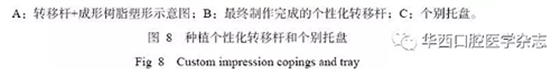 下頜骨腓骨移植聯(lián)合牙種植術(shù)后的覆蓋義齒修復(fù)1例 下頜骨腓骨移植聯(lián)合牙種植術(shù)后的覆蓋義齒修復(fù)1例