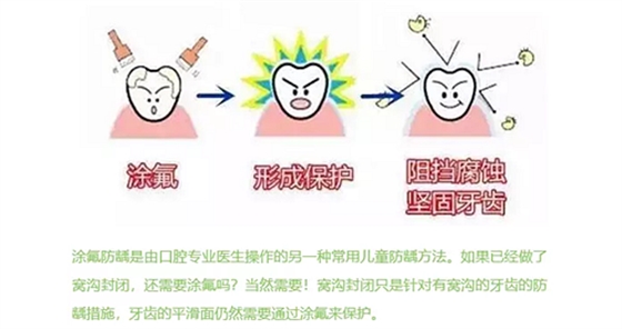 兒童齲病的預(yù)防 兒童齲病的預(yù)防