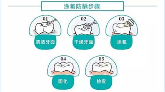 兒童齲病的預(yù)防 兒童齲病的預(yù)防