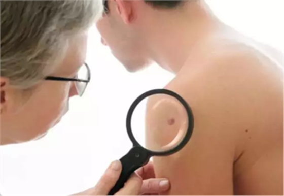 口腔預(yù)防 口腔預(yù)防