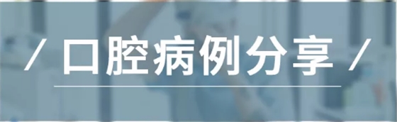 病例分享|復(fù)合樹脂微創(chuàng)美學(xué)修復(fù)關(guān)閉上前牙間隙 病例分享|復(fù)合樹脂微創(chuàng)美學(xué)修復(fù)關(guān)閉上前牙間隙