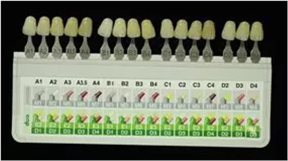 病例分享|復(fù)合樹脂微創(chuàng)美學(xué)修復(fù)關(guān)閉上前牙間隙 病例分享|復(fù)合樹脂微創(chuàng)美學(xué)修復(fù)關(guān)閉上前牙間隙