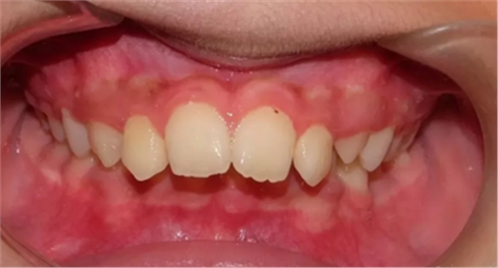 正畸矯正 正畸矯正