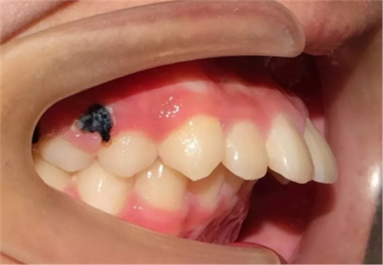 正畸矯正 正畸矯正