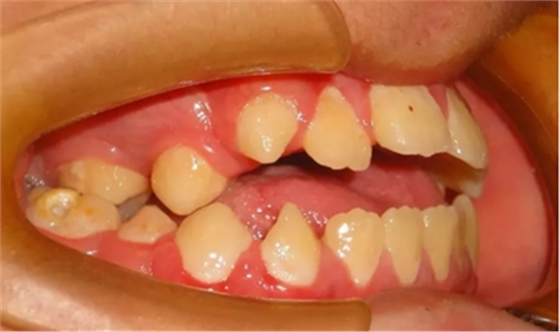 正畸矯正 正畸矯正