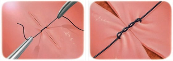 牙周顯微手術(shù)-翻瓣基礎(chǔ) 牙周顯微手術(shù)-翻瓣基礎(chǔ)