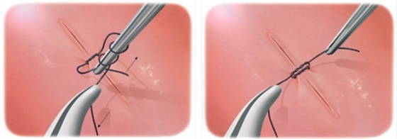 牙周顯微手術(shù)-翻瓣基礎(chǔ) 牙周顯微手術(shù)-翻瓣基礎(chǔ)