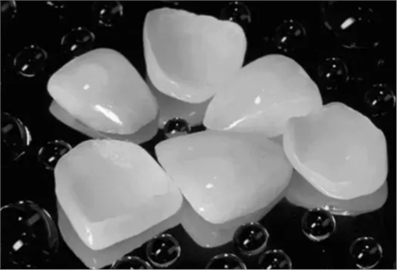 瓷貼面修復(fù)體最終顏色的影響因素 瓷貼面修復(fù)體最終顏色的影響因素