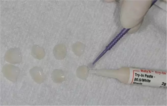 瓷貼面修復(fù)體最終顏色的影響因素 瓷貼面修復(fù)體最終顏色的影響因素