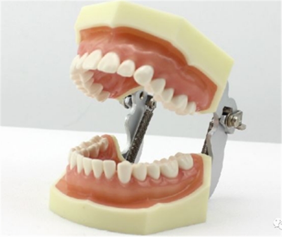 排牙后咬合關(guān)系的調(diào)整 排牙后咬合關(guān)系的調(diào)整