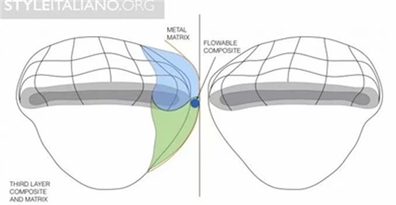 【分享】前翼技術(shù)關(guān)閉前牙間隙 【分享】前翼技術(shù)關(guān)閉前牙間隙
