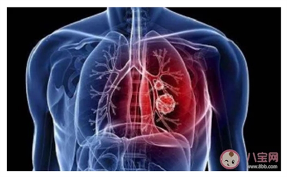 新型冠狀病毒感染了一定會發(fā)熱嗎？新型冠狀病毒前期的癥狀有哪些？