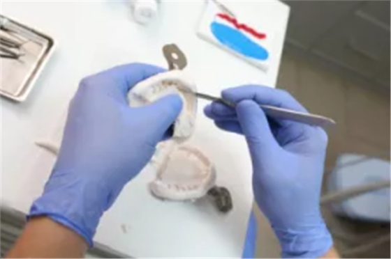 「傳統(tǒng)印模」or「數(shù)字化印?！梗∧＜夹g(shù)哪家強(qiáng)？