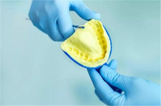 「傳統(tǒng)印模」or「數(shù)字化印?！?，印模技術(shù)哪家強(qiáng)？