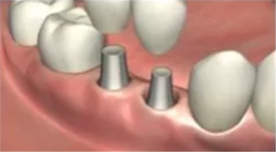 疫情期間，種植科突發(fā)狀況居家處理建議