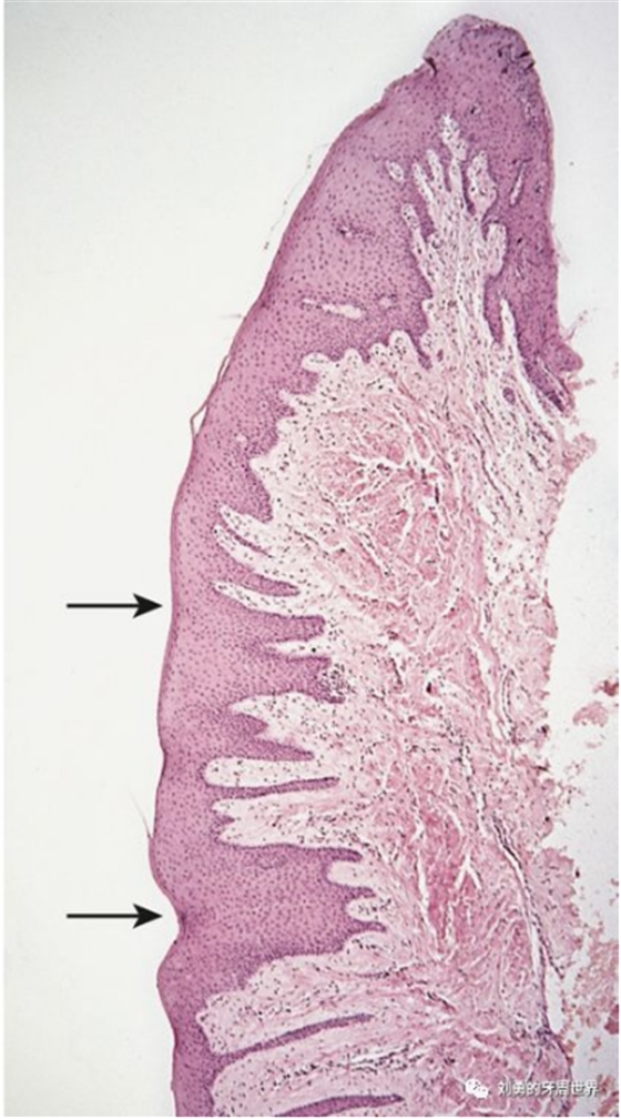 牙周解剖 牙周解剖